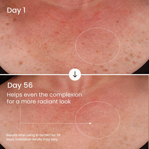 B-GLOWY Brightening Body Serum