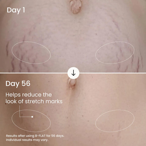B-FLAT Belly Firming Cream