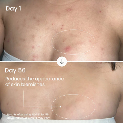 RE-SET Balancing Body Serum