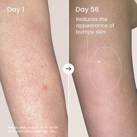 RE-START Resurfacing Body Serum