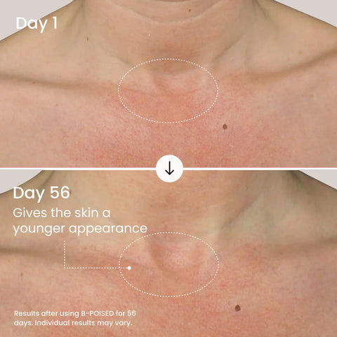 B-POISED Neck & Décolleté Firming Cream
