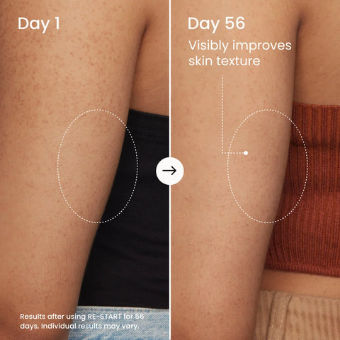 RE-START Resurfacing Body Serum